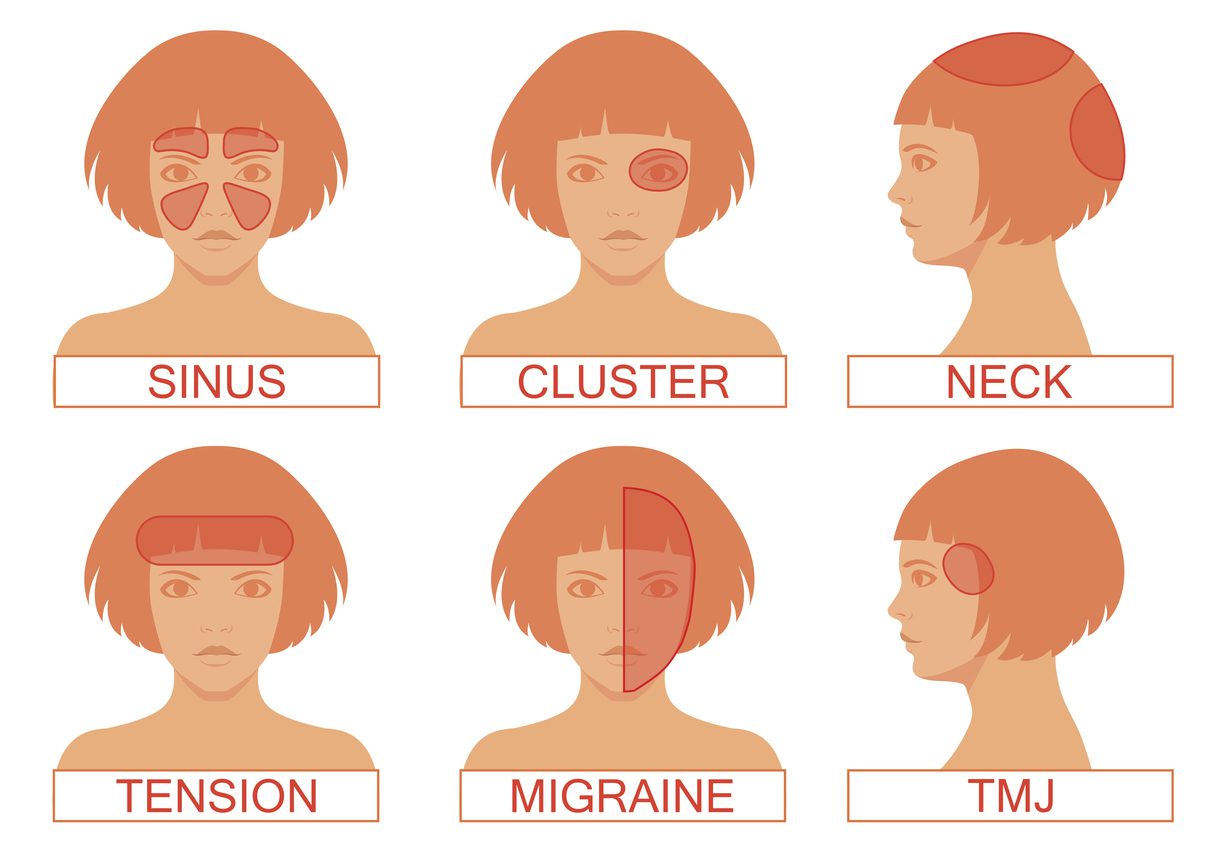 how-to-know-if-you-have-a-headache-or-migraine