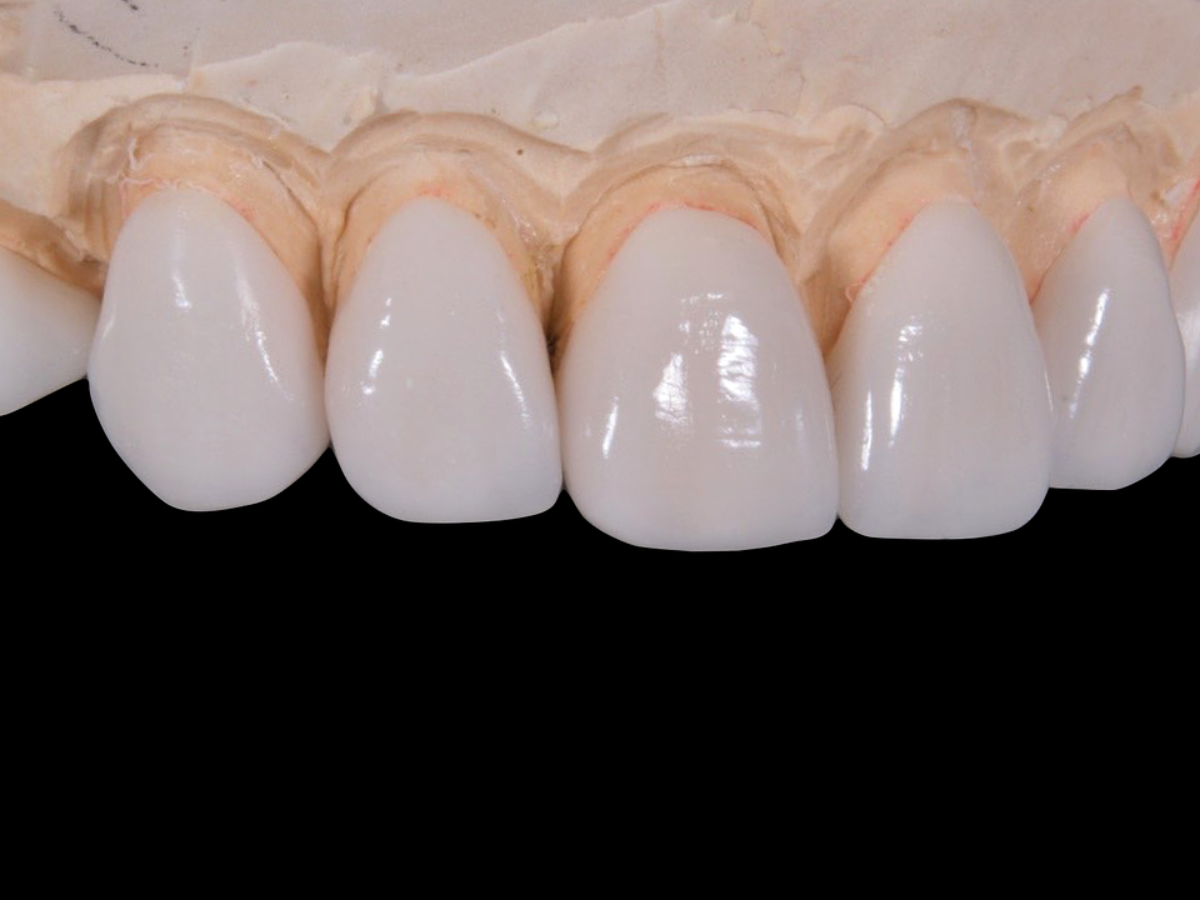 3D Teeth Offer Many Benefits for Dental Patients