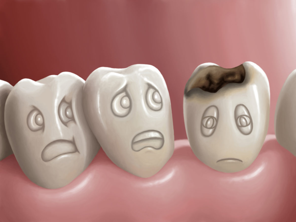 How do you Know if you have a Rotten Tooth?