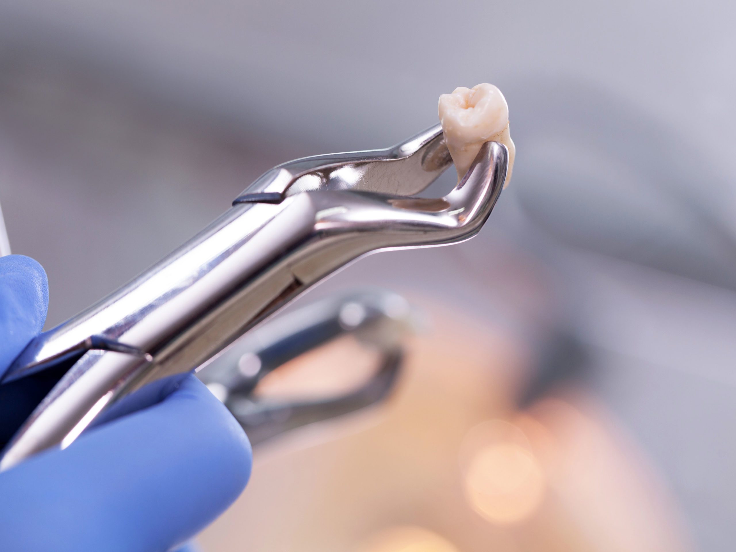 Extractions-Left-Column