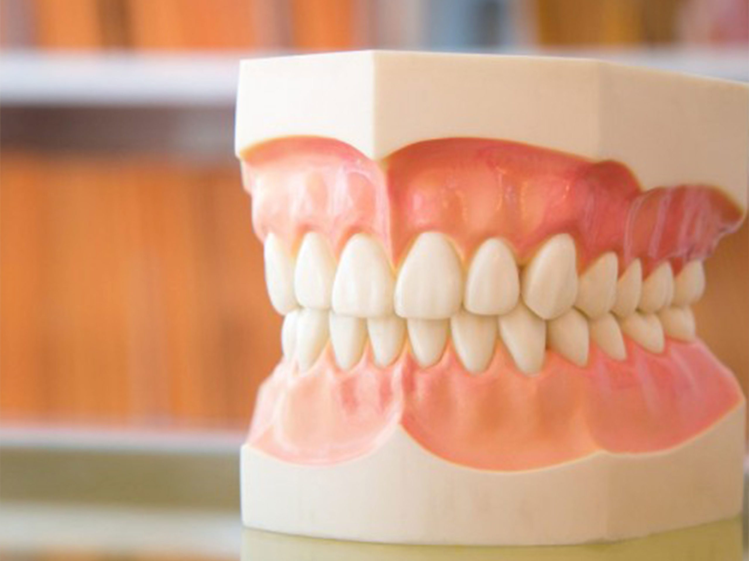 Gum-Recession-Right-Column