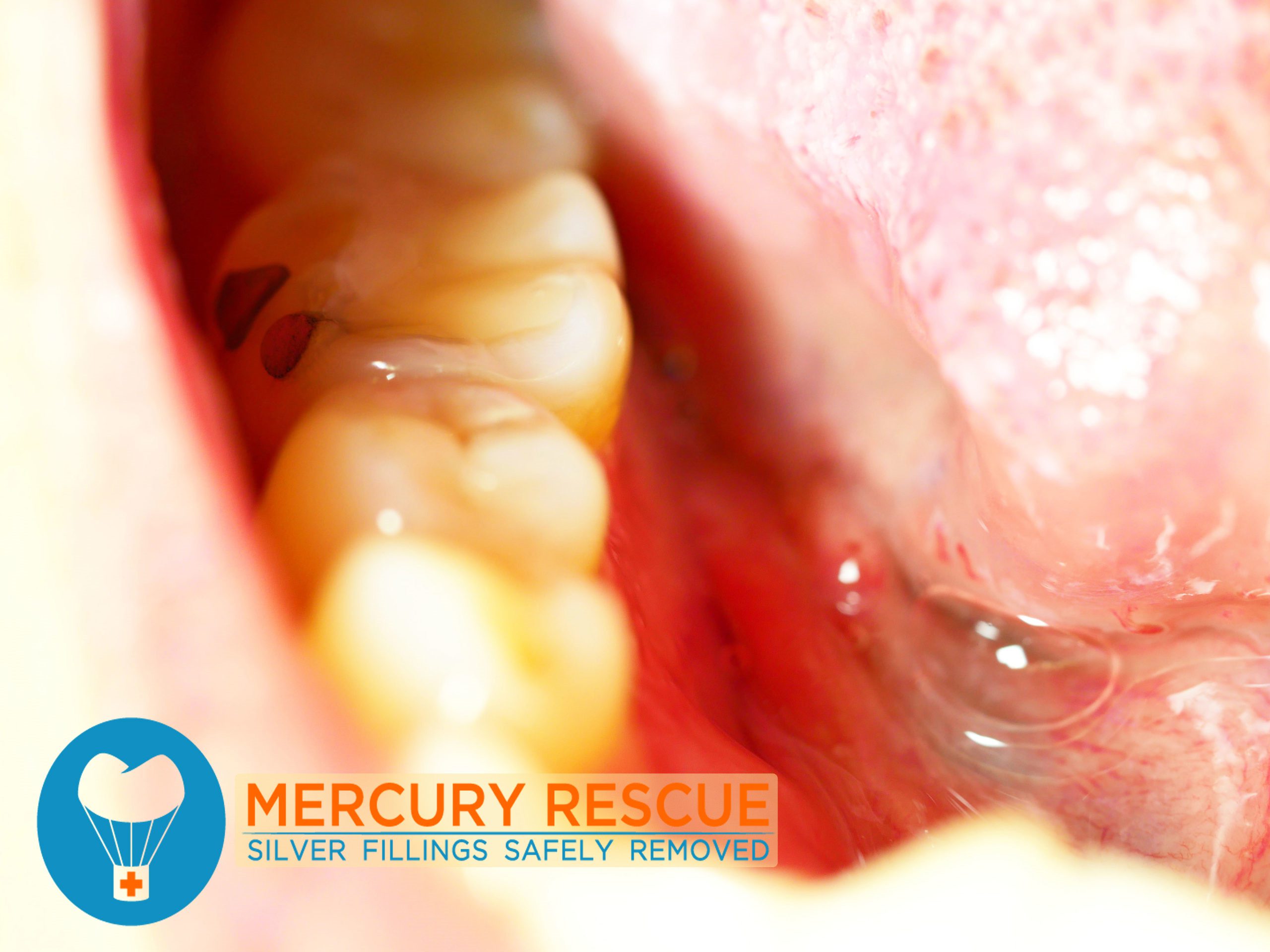 Mercury-Rescue-Right-Column-scaled