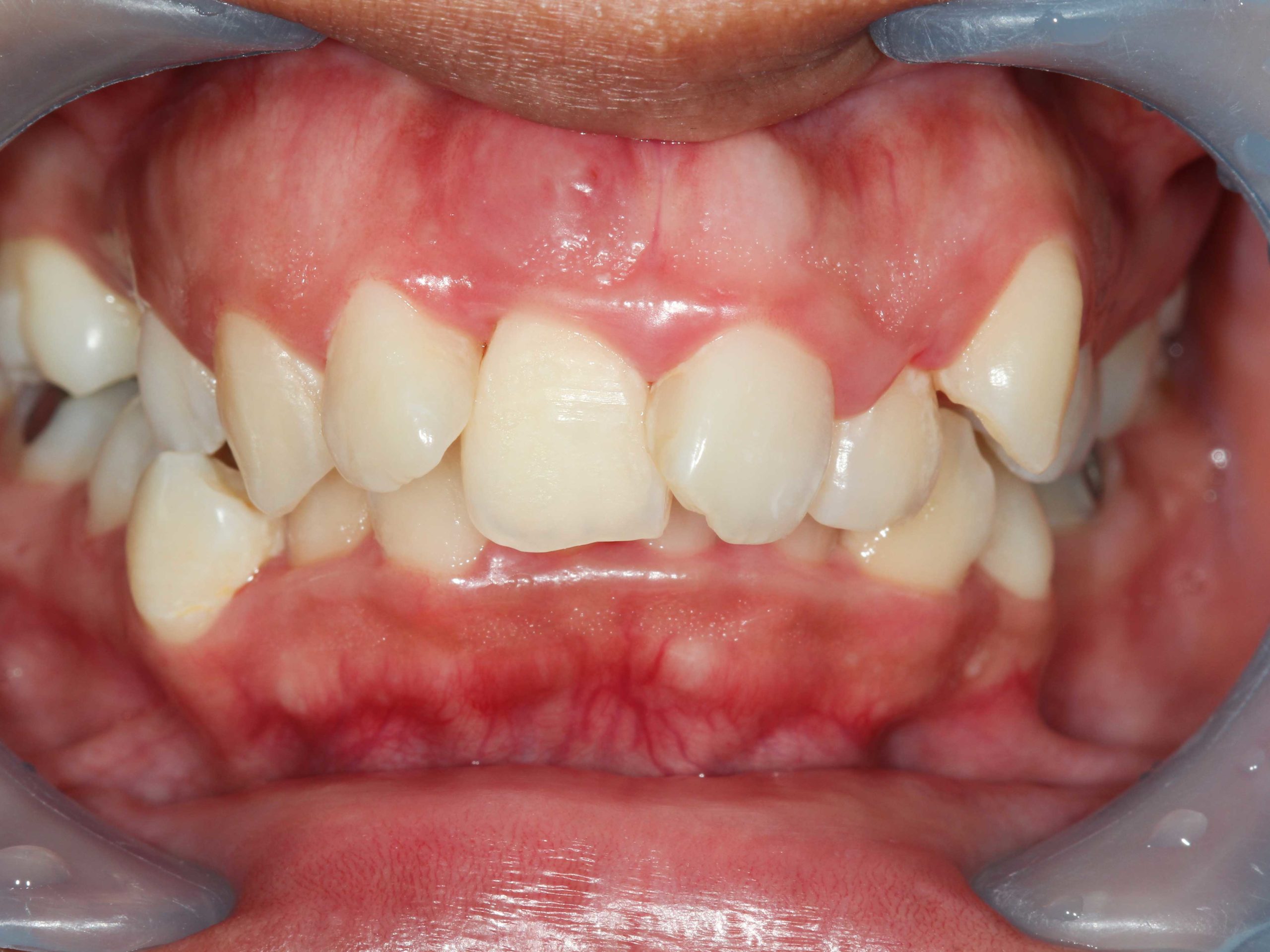 Signs-and-Symptoms-Right-Column