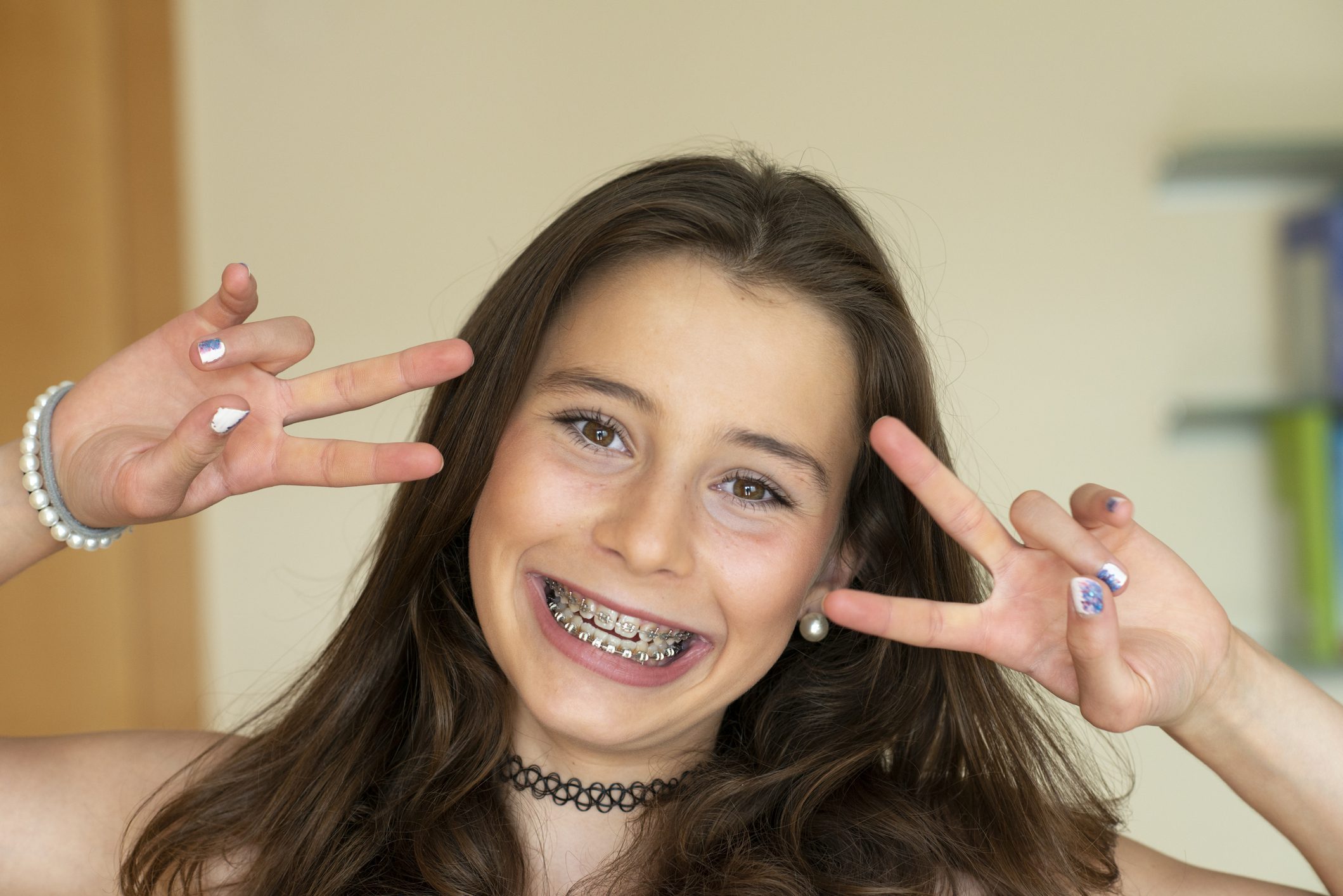 What Do Invisible Braces Look Like? - Lilburn Family Dentistry Lilburn  Georgia
