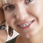 fast-braces-round