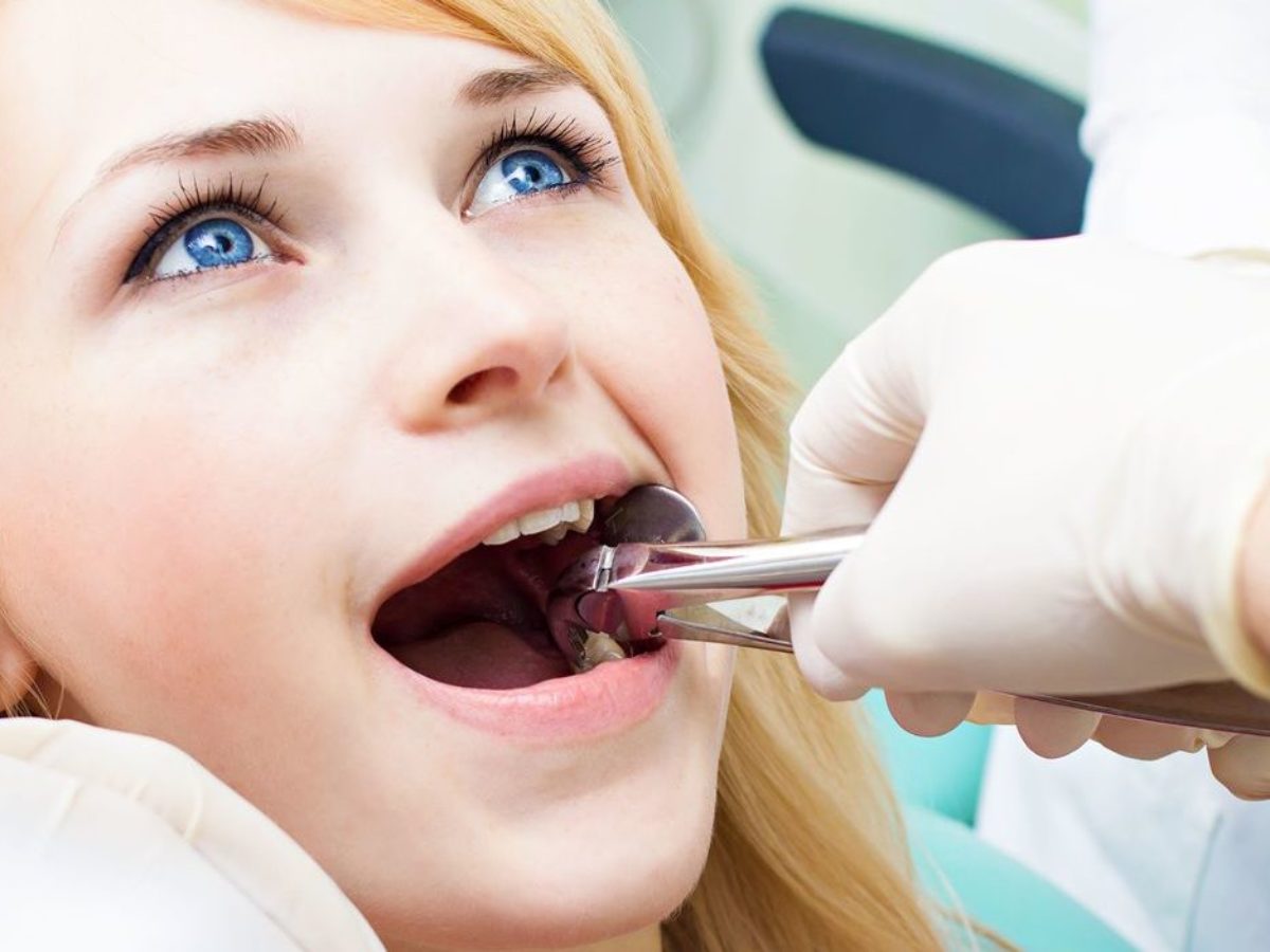 Surgical Tooth Extraction What To Expect Gilbertandblakes 