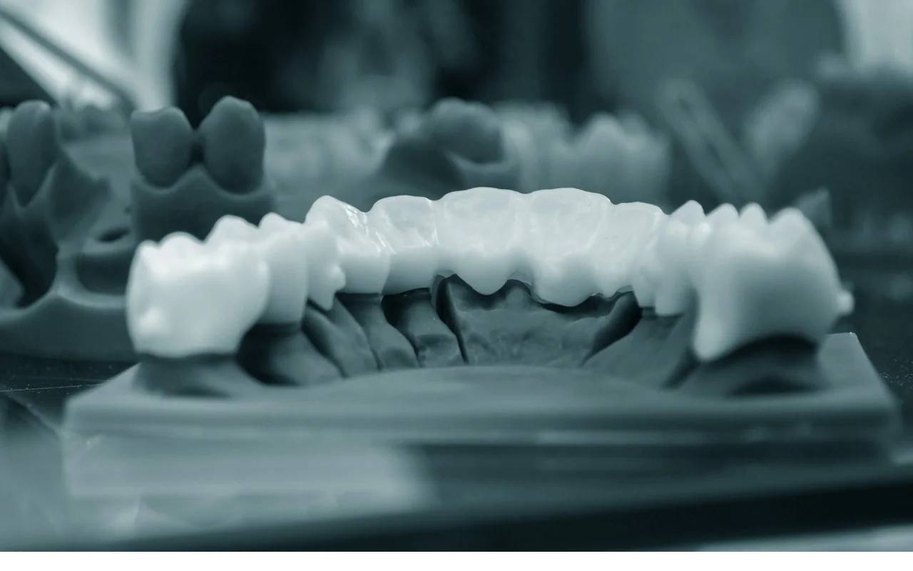 Uses of Dental AI in Prosthodontics