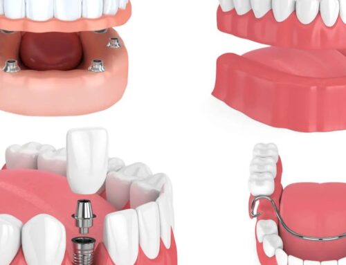 Dentures & Dental Implants